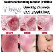 https://ae-pic-a1.aliexpress-media.com/kf/S08d0889c0b0e4975937429dfb8cbcba3X.jpg_500x500.jpg_.webp